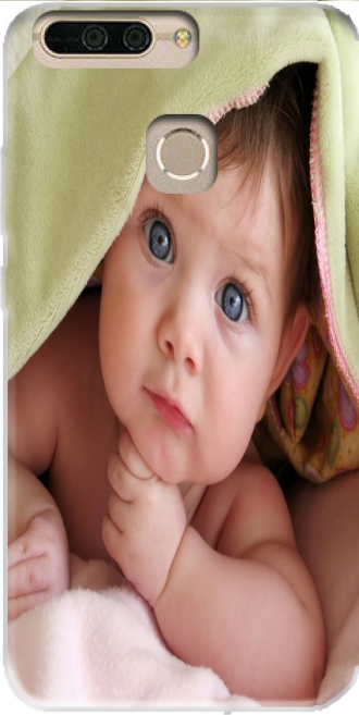 Capa Honor V9 / Honor 8 Pro com imagens baby