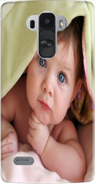 Silicone LG G4 Stylus com imagens baby