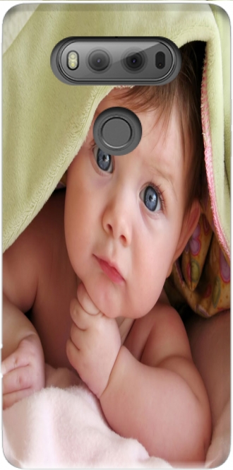 Silicone LG V20 com imagens baby
