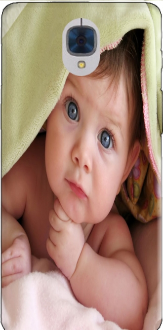 Capa OnePlus 3 com imagens baby