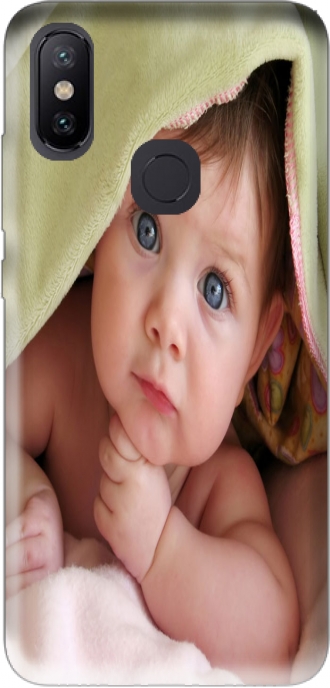 Capa Xiaomi Mi A2 / Xiaomi 6x com imagens baby