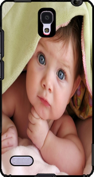 Capa Xiaomi Redmi Hongmi Note 4G com imagens baby