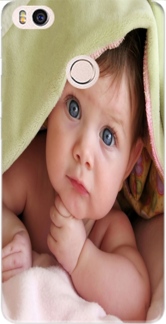 Capa Xiaomi Mi 4s com imagens baby